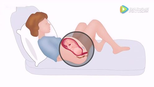 的孕妇美伢在旁边看傻了,小新扮演0:00:53上传者:黏人的动漫女王时 间