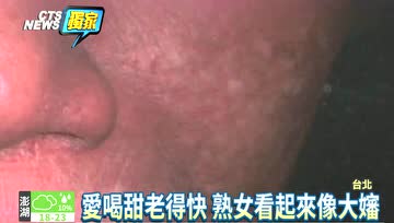 吃太甜老得快，爱吃甜食的朋友可要注意了