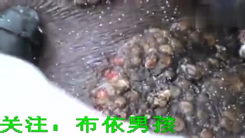 非洲沙蚤寄生虫 腾讯视频