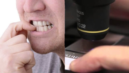 手指甲在显微镜下放大100倍,看完你还敢乱啃吗?