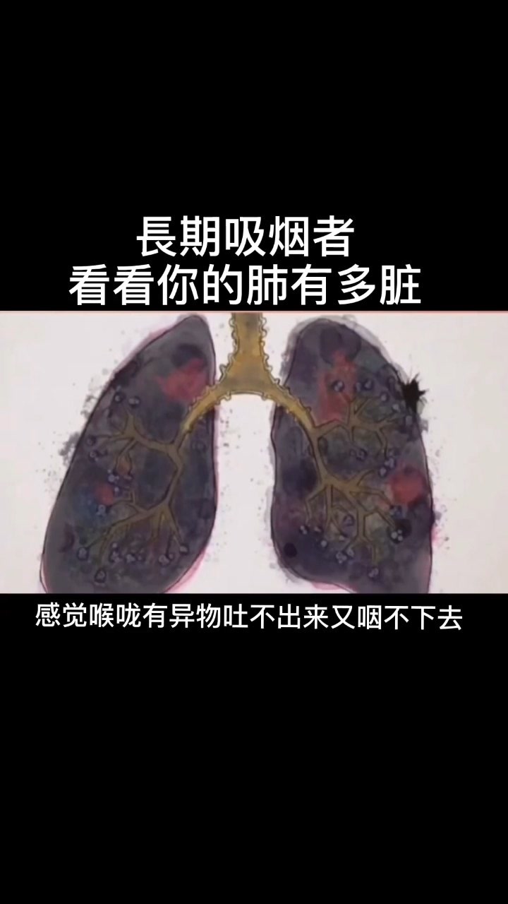 长期吸烟者 看看你的肺有多脏