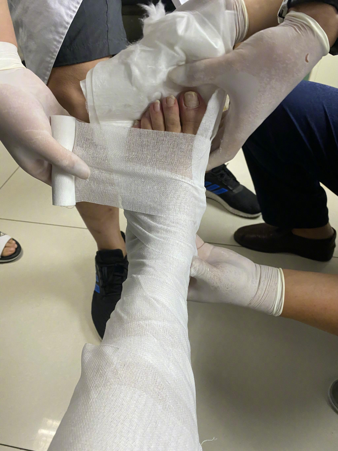 没有因为受伤而停工,那出品方的损失就太大了脚受伤已经是第十一天了