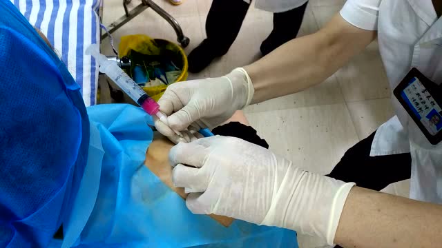 水针刀治疗肩周炎