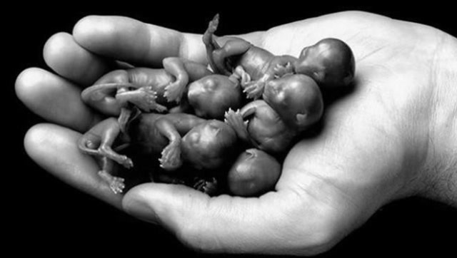 堕胎胎儿图片