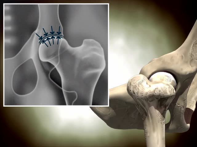 犬正常髋关节动画