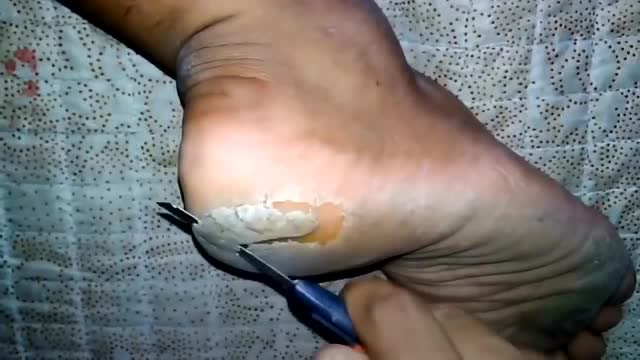 修脚,切脚皮,刀削面呲溜