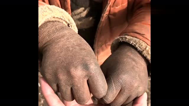 贫困山区孩子的手图片