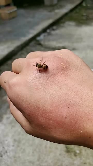 被蜜蜂蛰了之后的照片图片