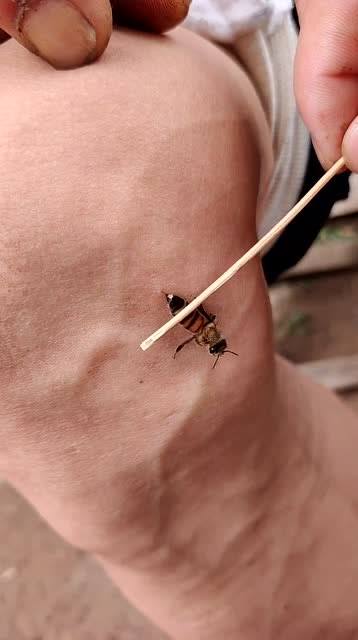 看看蜜蜂多残忍,哲完人就跑,刺留肉里还在动