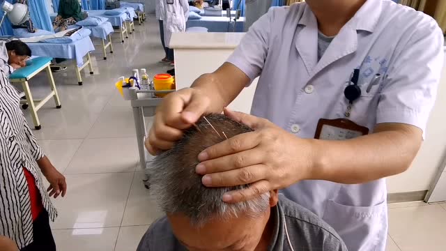 偏瘫头针疗法 偏瘫患者针灸疗法02 如何在偏瘫患者头部针灸