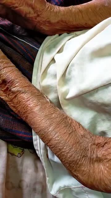 泰国一位92岁老奶奶的手臂,每一寸肌肤都留下了岁月的痕迹.