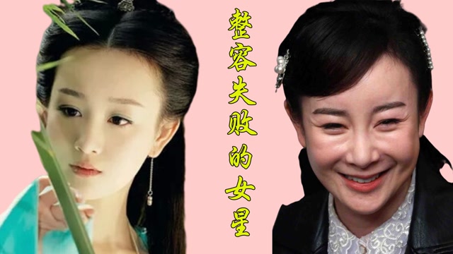 整容失败的12位女星王祖贤女神变女鬼张檬取出假体王者回归