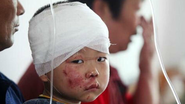 受伤宝宝的正确处理方法,家长们一定要牢记,事关宝宝的生命安全