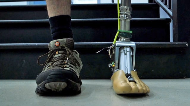 残疾人的福音!智能假肢踝关节,你也可以健步如飞!