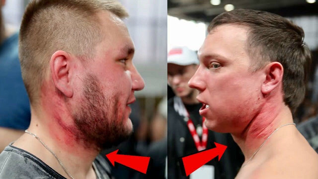 俄罗斯奇葩"打脸"比赛,一个个打得面红耳赤,最后都被打成猪头!