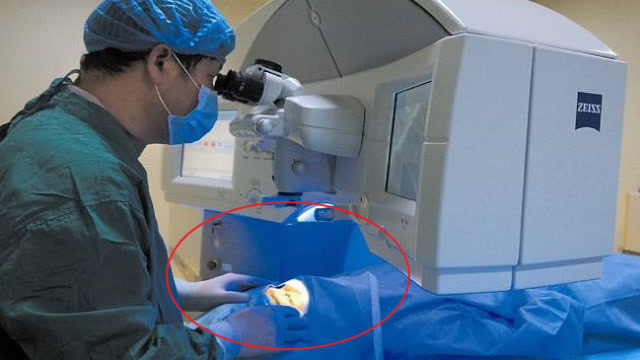 第一批做激光治疗近视的人,现在的生活变成了这样