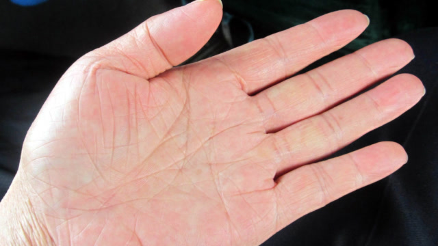 好消息!通过左手掌这个部位可以看出胃癌,赶快自测下吧!