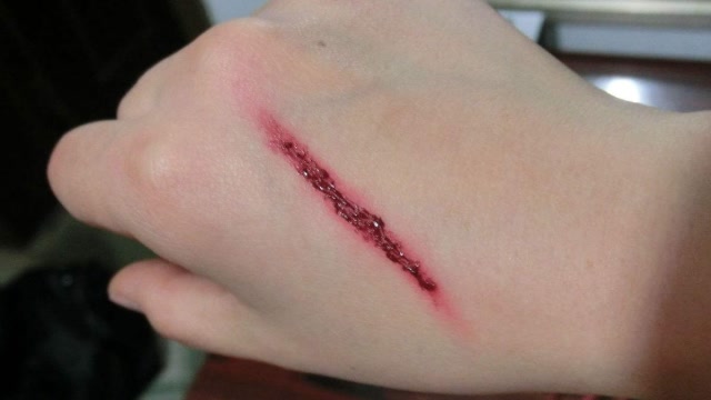 人体受伤后伤口怎么愈合的?当显微镜放大50倍后,实在不可思议