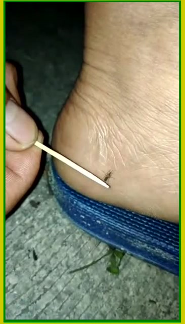 人得有多么无聊,才能想的出这样的抓蚊子的方法,真是有才!