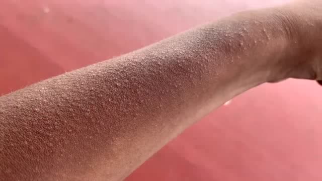小伙海南徒步近十天,胳膊上成了这样,看的人密集恐惧症都出来了