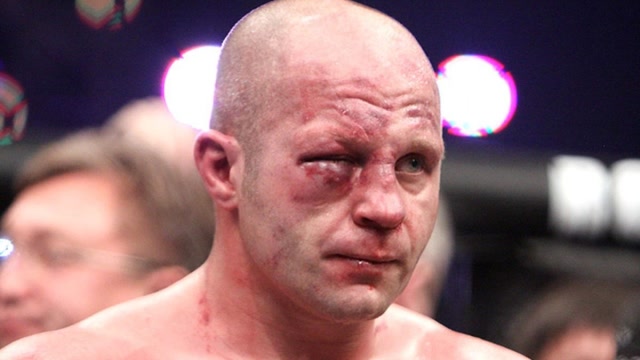 席尔瓦vs菲多王者对决!格斗界最强男被打得鼻青脸肿遭惨败