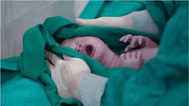 新生儿多重最合适?让大家看看刚出生8斤多的婴儿,有啥不同