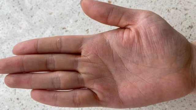 手相讲解女人手掌大厚而有肉好吗手背上有肉窝有肉好还是柴好