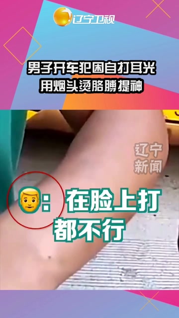 男子开车犯困狂扇自己耳光,用烟头烫胳膊提神,民警看后直言心疼