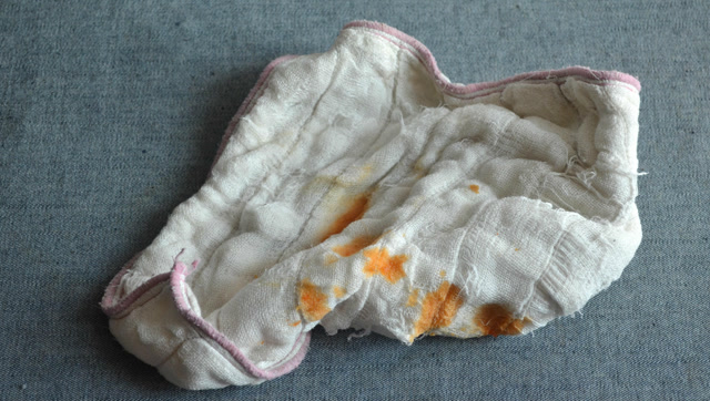 厨房抹布油腻不好洗?只需水里加点它,洗完抹布比洗脸毛巾还干净