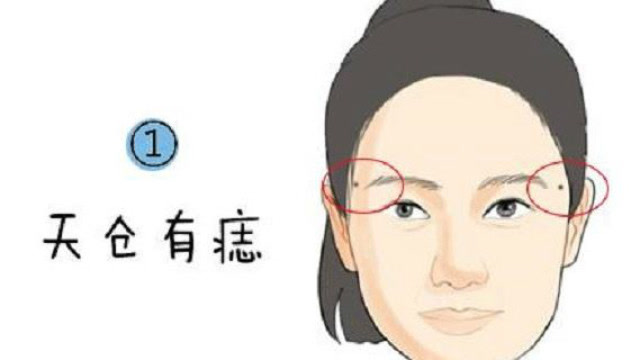 天仓有痣,主富,天生有钱