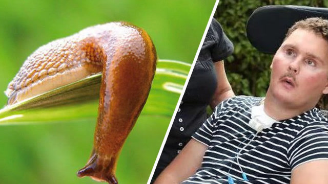 国外男子作死生吃蜗牛!导致全身瘫痪!