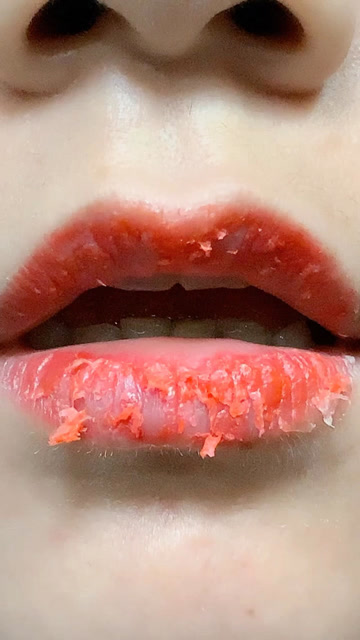 换季嘴唇干裂起皮,涂口红难看怎么办