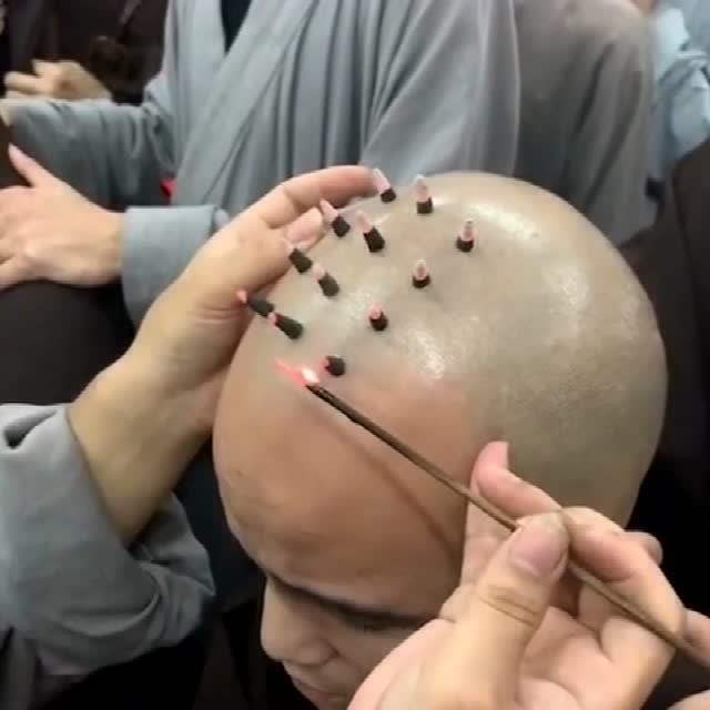 原来和尚头上的戒疤是这样烫出来的,隔着屏幕都觉得疼!