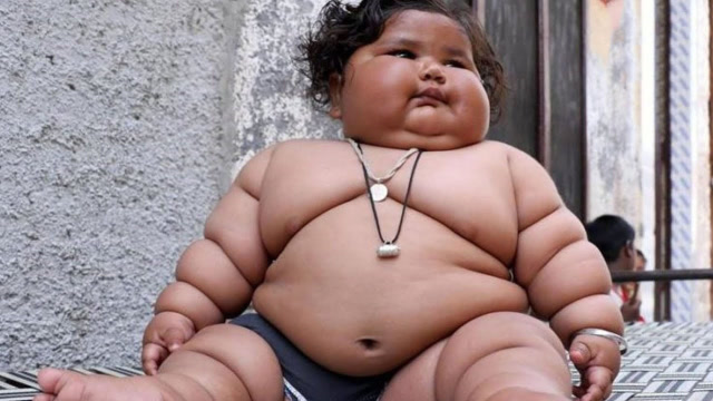 世界上最胖的小男孩,仅仅两年狂瘦204斤,效果堪比整容!