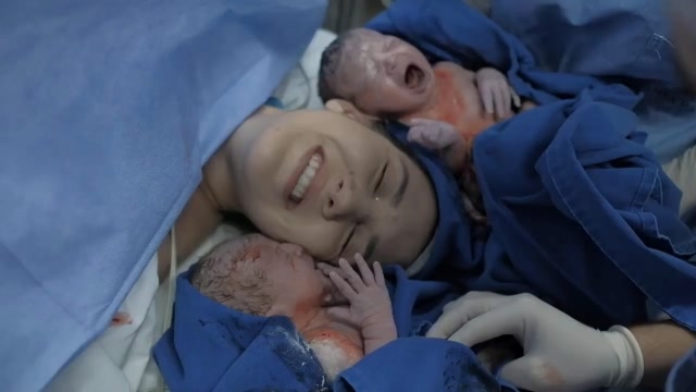 产房实拍孕妇剖腹产生双胞胎全过程好想也生一对这么可爱的宝宝