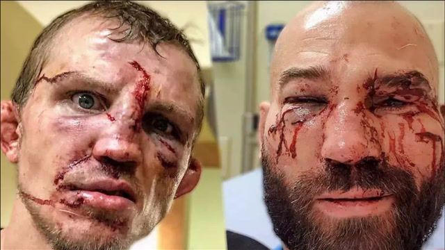 拳击台上最不要命的对攻!疯狂互殴,双方都打被打的鼻青脸肿