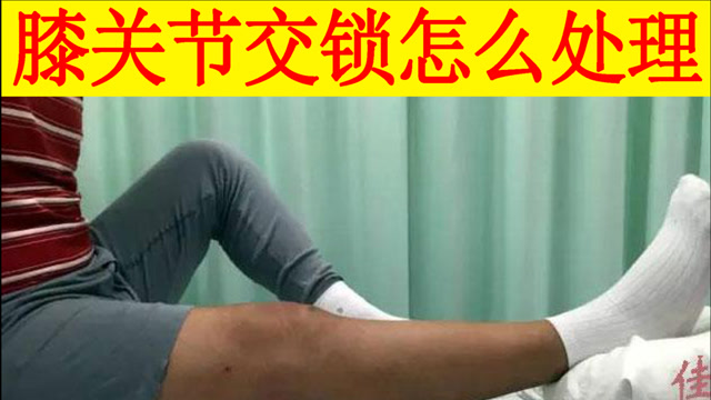 膝关节交锁怎么回事要手术吗为什么有时手术效果不好还复发