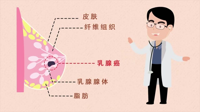 经常看到有女性因为乳腺癌而切除乳房的,你知道什么是乳腺癌吗?