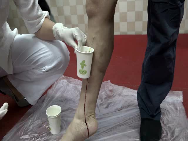 功效与作用及用法_功效与作用的功效与作用是什么_少商放血的功效与作用图片