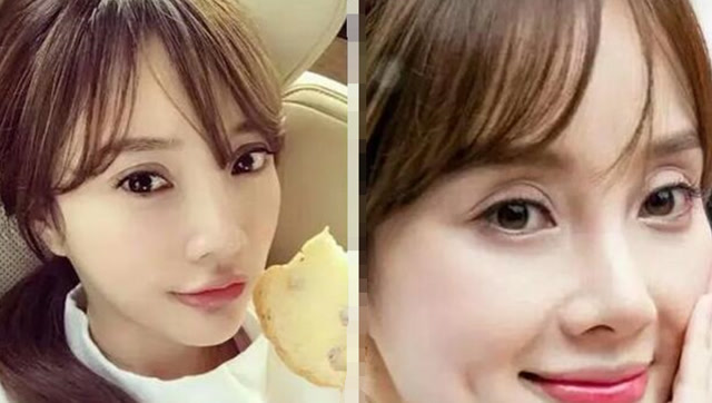 女明星贴双眼皮!杨幂千层褶,李小璐眼皮能夹死蚊子!