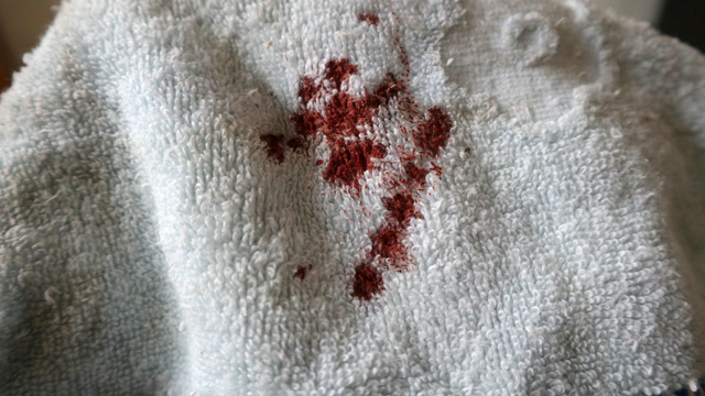 衣服床单染上血渍别着急,学会这招轻松去除干净,很适合女生