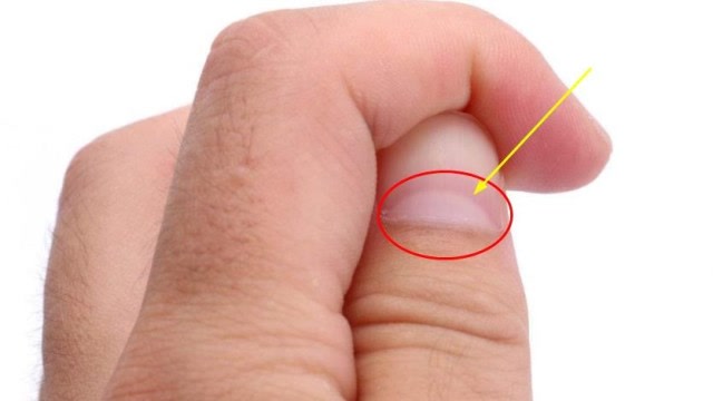 手指上的"小月牙"和身体健康有关系吗?真的有,但不是你想的那样