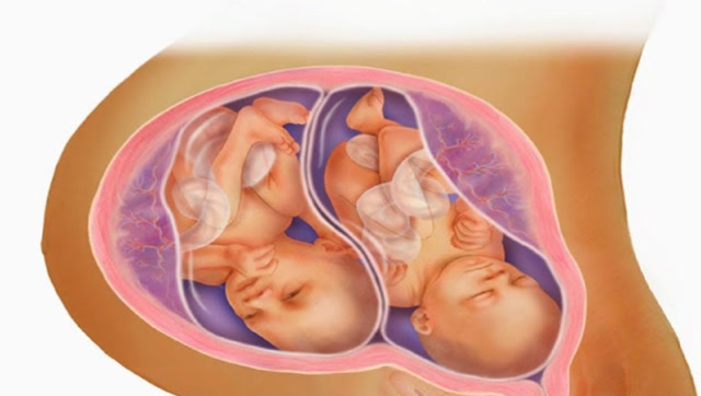 双胞胎怀孕过程图片