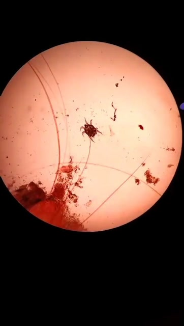 显微镜下的蜱虫图片