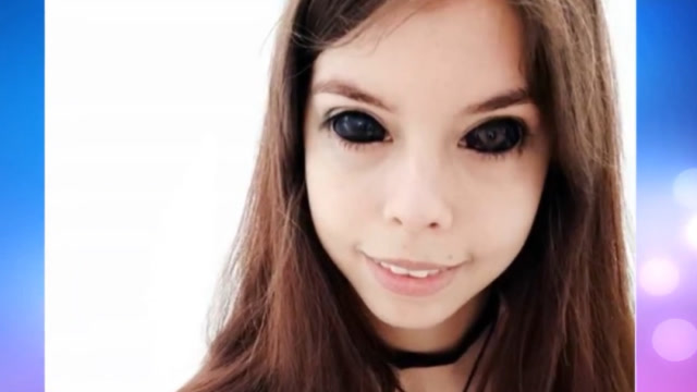 作死!美女赶时髦竟将眼球全染黑,手术后一只半残,一只永久失明