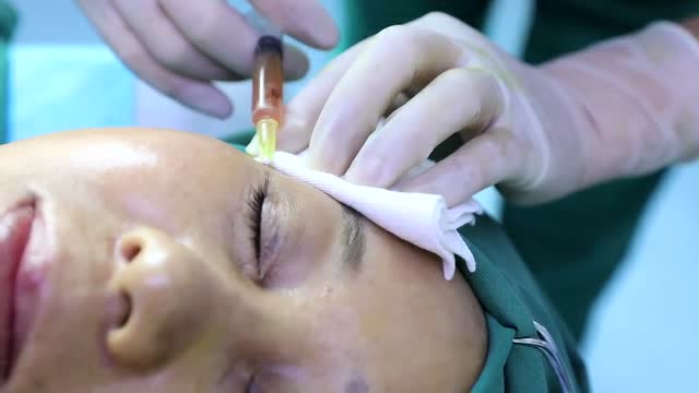 伊杜娜皮肤银行cgf鱼尾纹填充临床注射视频