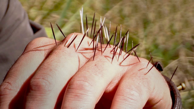 yoo视频精选被豪猪刺扎是怎样的体验老外作死挑战意外发生了