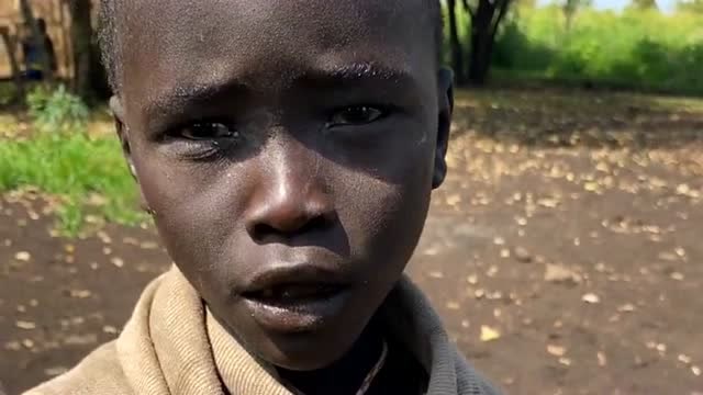 非洲挨饿的孩子图片