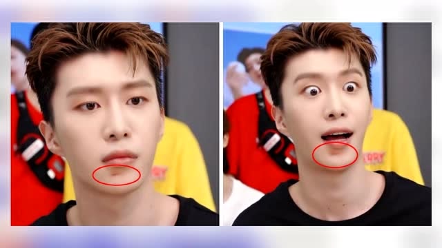 网曝范丞丞洗澡摔倒磕破下巴 最新出镜照伤口明显