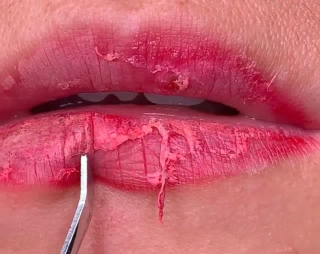 天冷了嘴唇干裂起皮,撕下来那一刻我看着都疼!